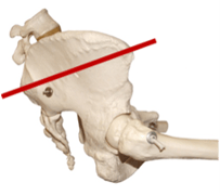 pelvic tilt illustration